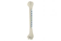 Humerus Diyafiz Plakları